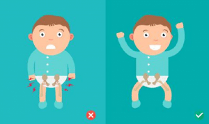 Cómo se puede corregir la displasia de caderas en los bebés