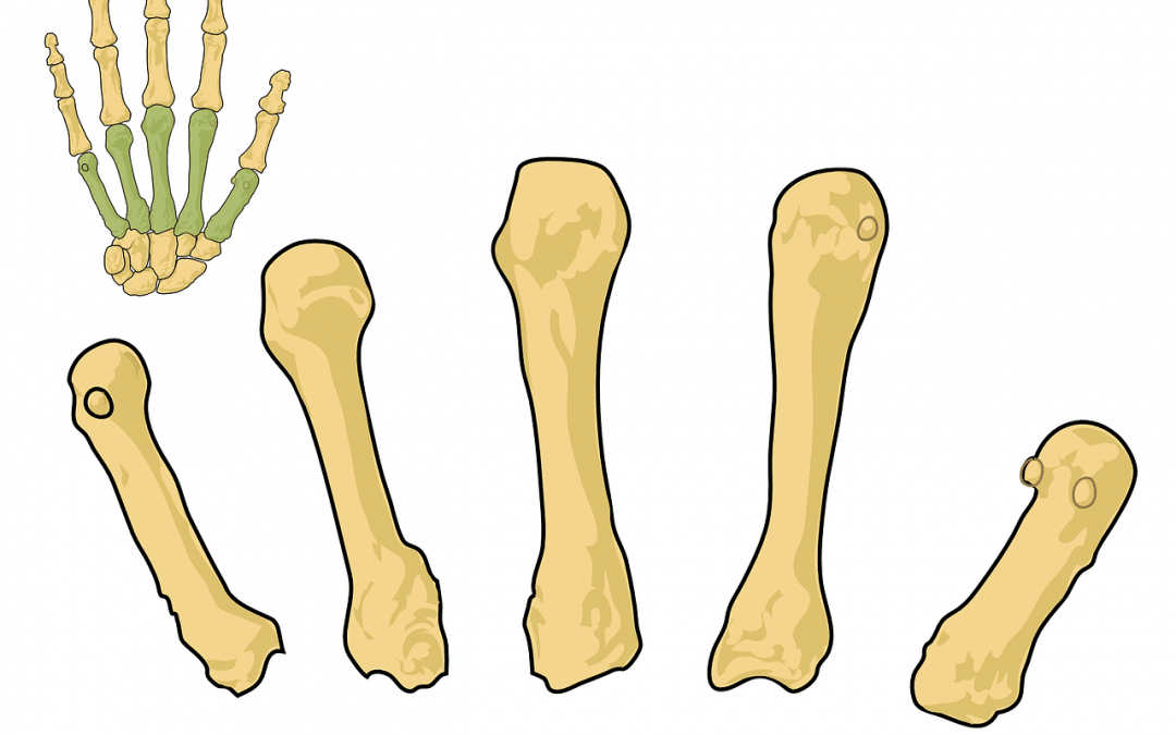 Principales riesgos de padecer Osteoporosis